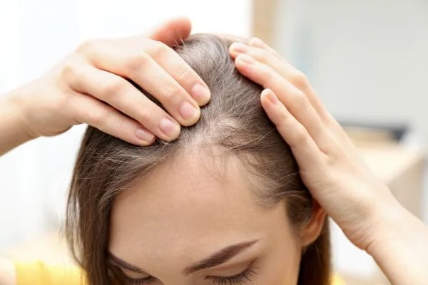 perte cheveux femme chute de cheveux